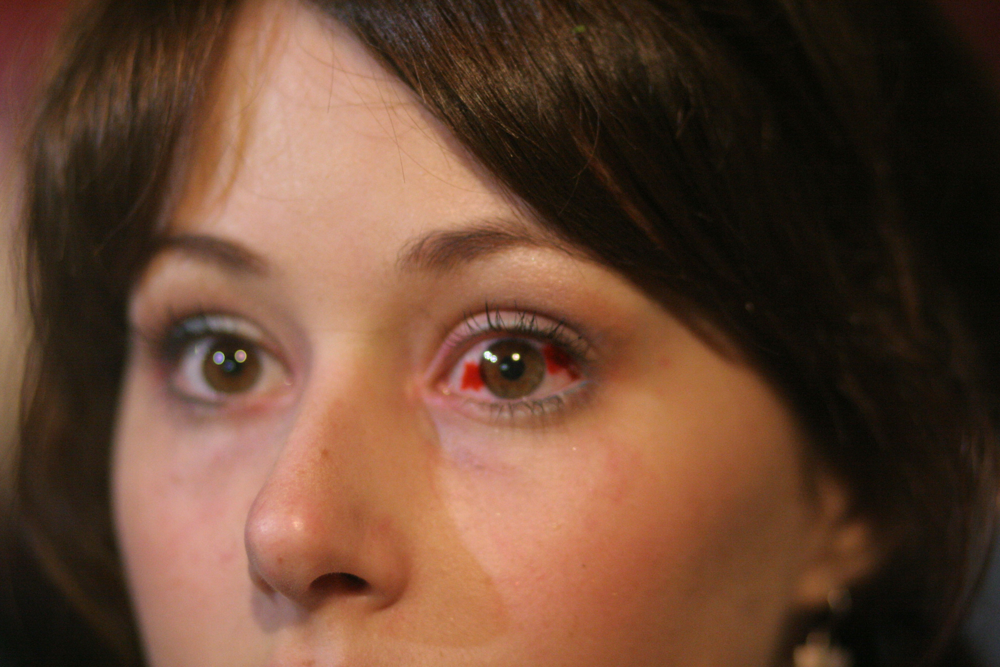 Close-up of Wendy’s bloodshot eye.
