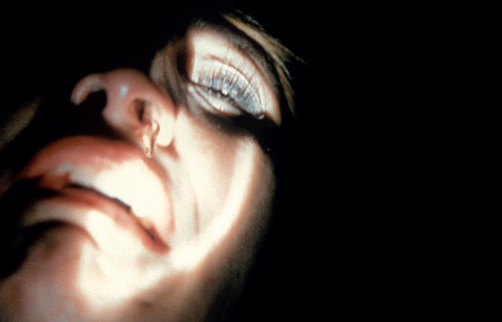 Cindy with a bruised eye.